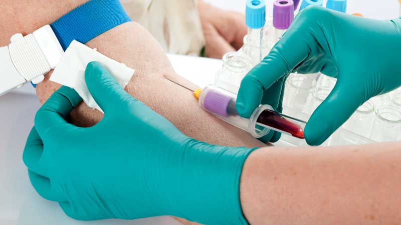 Blood Tests Detect Depression